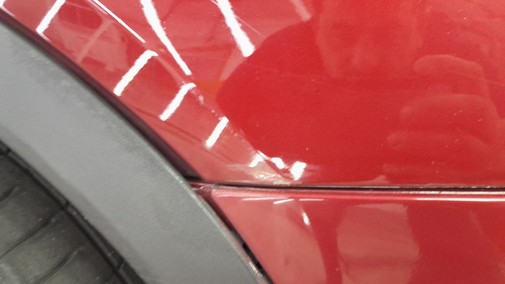 thumbs